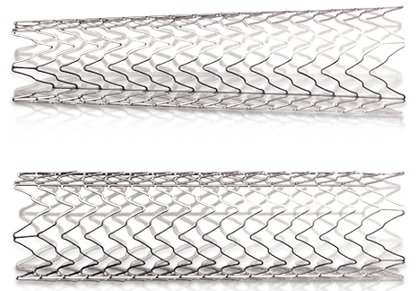 Abbott RX AccuLink rapid-exchange carotid stent system